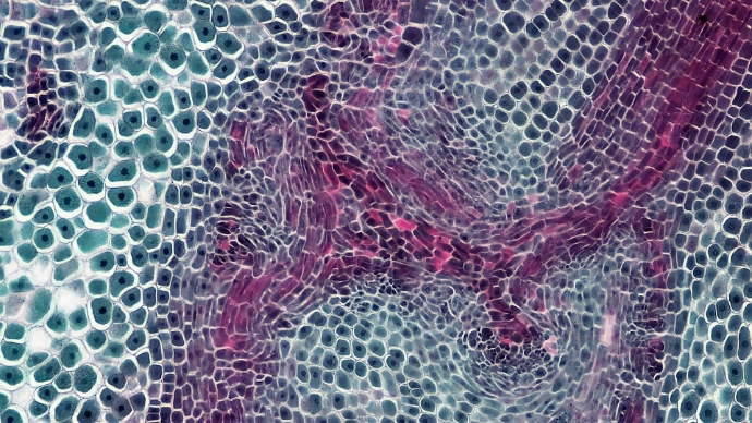 Microscopic view of plant cells with purple vascular tissue